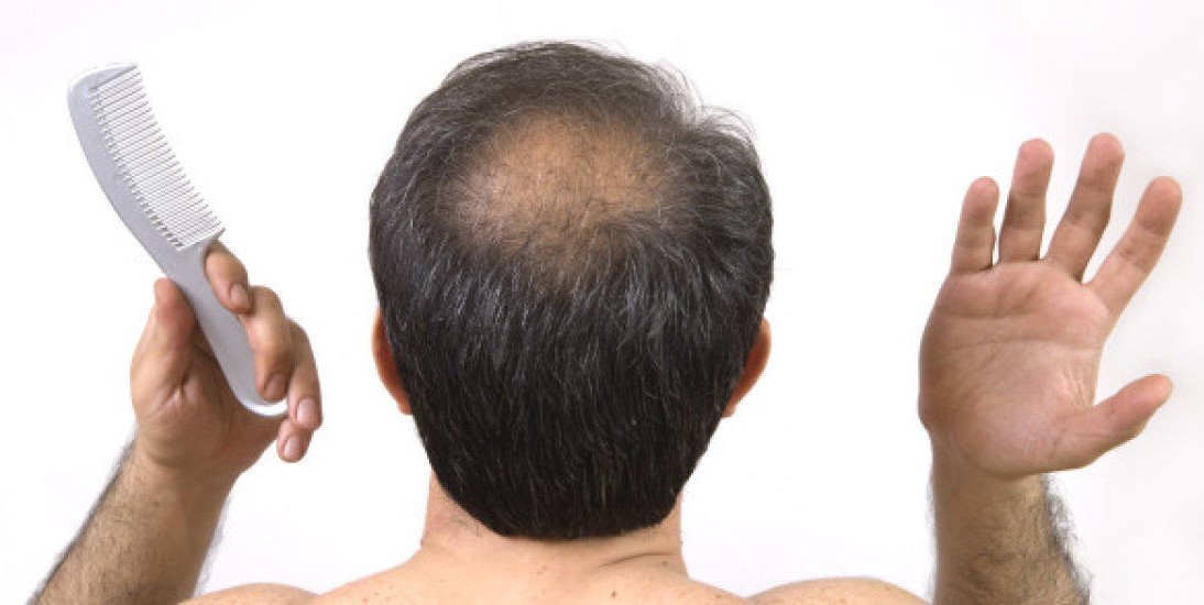 Hair loss treatment scams